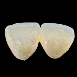 e.max