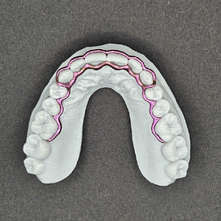Atlas Retainer Set - Titanium
